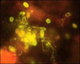 image of antibody-based immunofluorescence identification.